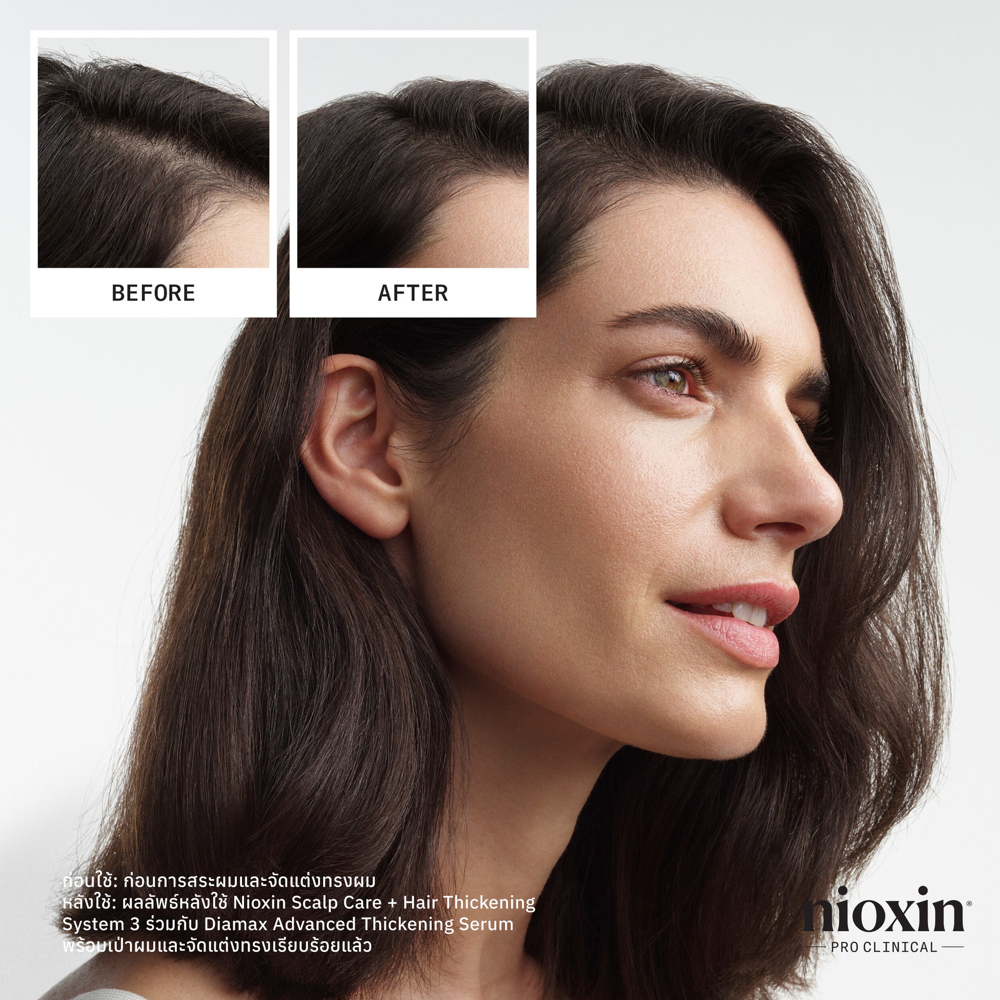 NIOXIN - System 3 Shampoo 300ml/1000ml - OCC LIFE
