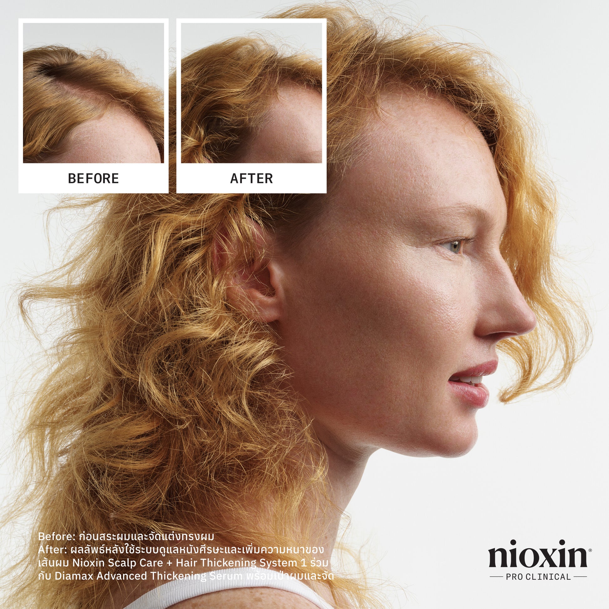 NIOXIN - System 1 Conditioner 300ml/1000ml - OCC LIFE
